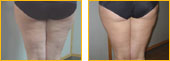 VacuStep before and after - click for closeup